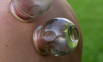 Up to 40% Off on Cupping at Lucky Cat Acupuncture