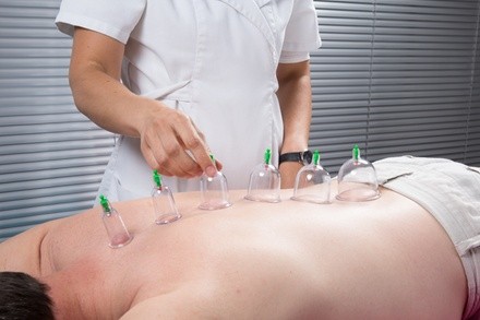 One or Three Cupping Sessions at Options Rehab (Up to 74% Off) 