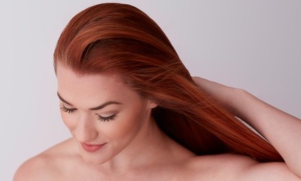 $669 for Four Platelet-Rich Plasma Hair Treatments at Timeless Regenerative Aesthetics ($796 Value)
