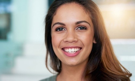 One or Two Diamond Microdermabrasion Facial Treatments at aSPAthecary (Up to 55% Off)