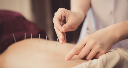 Up to 70% Off on Acupuncture at Advance Healing Clinic