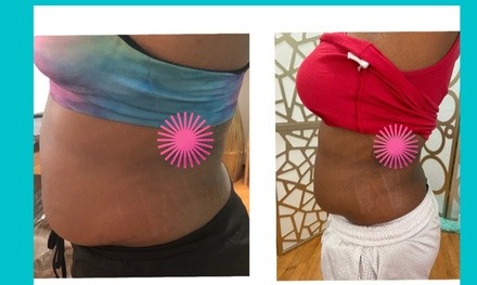 Up to 60% Off on Cavitation at TLC SELFCARE LLC