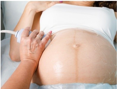 Up to 36% Off on Ultrasound - 3D / 4D at Perfect Image Beauty