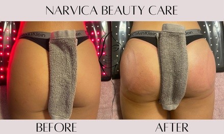 Up to 83% Off on Non-Surgical Butt Lift at Narvica