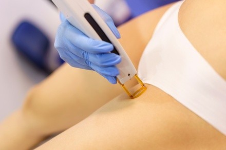 Up to 63% Off on Laser Hair Removal at SKINFETCH MIAMI CLINIC, LLC