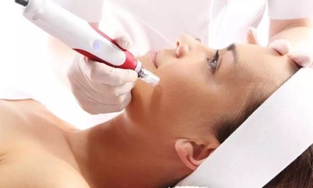 One or Three Partial-Face, Full-Face, or Face and Neck Microneedling Sessions at Aesderma Medspa (Up to 38% Off)