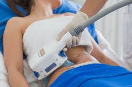 Up to 45% Off on CoolSculpting at BodiSnatcher Studio Llc