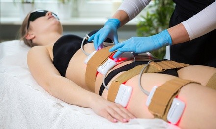 Laser-Lipo Session for 1, 3, 4, or 6 Areas with WBV at B. Baddie Body (Up to 34% Off). Eight Options Available.