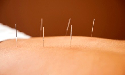 Up to 60% Off on Acupuncture Services at Barefoot Taoists