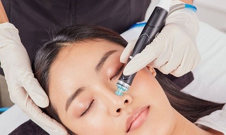 Up to 25% Off on HydraFacial at Skinlicious Laser & Aesthetics