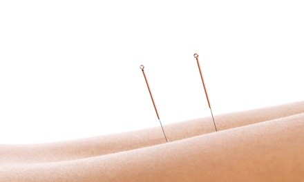 Up to 45% Off on Acupuncture at Urban Acupuncture Center