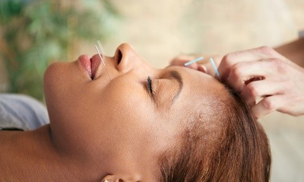 Four-, Five-, or Seven-Step Acupuncture Packages at Acupuncture and Holistic Health Associates (Up to 92% Off)