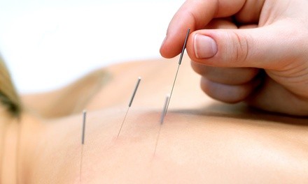 Initial Consultation and One or Three Acupuncture Treatments at Cape Coral Acupuncture Clinic (Up to 82% Off) 