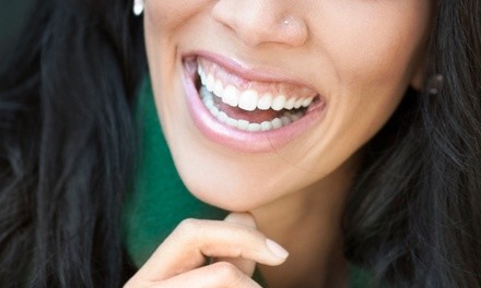 Up to 79% Off on Dental Checkup at PDC MSO