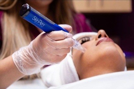 Up to 25% Off on Micro-Needling at Blackstone Vision & Med Spa