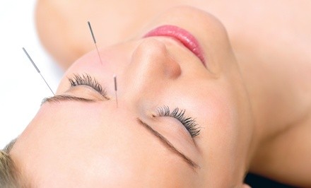 Up to 54% Off on Acupuncture Services at Guhn Holistic