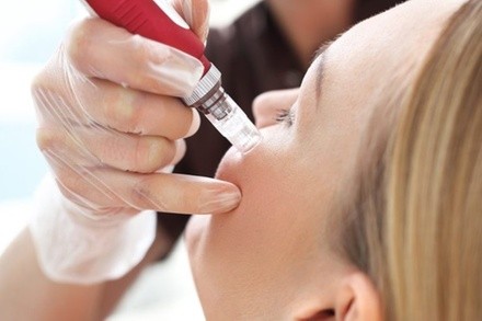 Up to 58% Off on Microneedling at Shannon Lee Esthetics