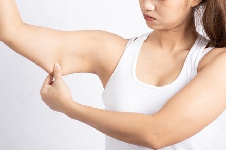 Two, Four, or Six Non-Invasive Laser Arm Fat-Reduction Treatments at L.A. Slim (Up to 93% Off)