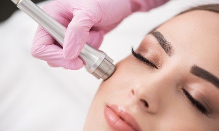 One or Two DiamondGlow Microdermabrasion Facials at Summit MedAesthetics (Up to 22% Off)