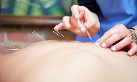 Private or Community Acupuncture with Initial Consultation at Healing Arts Community Acupuncture (Up to 48% Off)