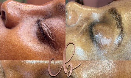 Up to 61% Off on Chemical Peel at Corinthiansbeauty Llc