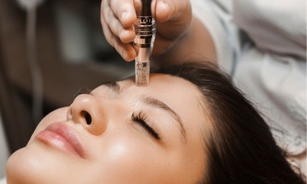 Up to 50% Off on Micro-Needling at Sweet Skin by Gaby Med Spa