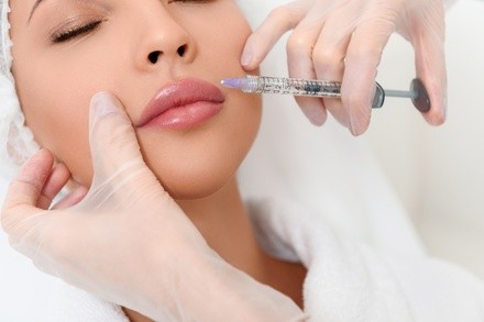 One 1.2ml Syringe of Revanesse Versa for Lips at KLS Aesthetics (Up to 28% Off)