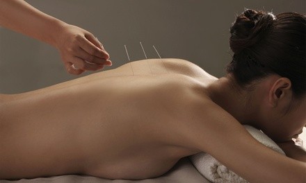 One or Three Acupuncture Treatments with Chi Machine Massage at Sean's Massage Center (Up to 74% Off)