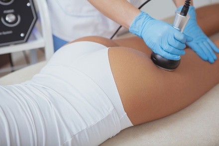 Up to 80% Off on Lipo - Invasive Laser-Smart Lipo at Aesthetics Beauty Laser