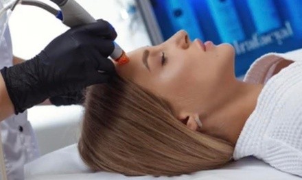 Up to 79% Off on Chemical Peel at Forever Medical Spa