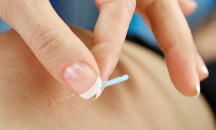 Up to 48% Off on Acupuncture Services at Family Care Acupuncture and Herbs