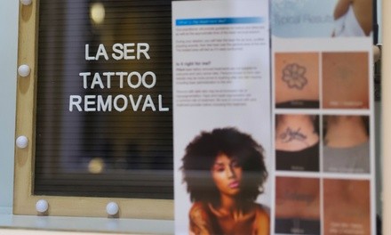 Up to 55% Off on Tattoo Removal at Miss Cassie's Laser tattoo removal