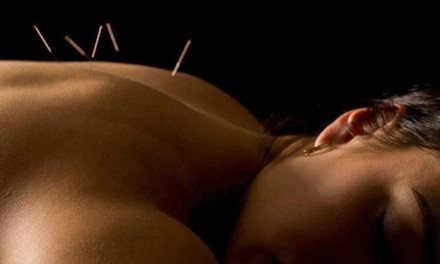 Acupuncture, PEMF Therapy, Neuroprogramming at Ravive Health & Vitality (Up to 53% Off). 3 Options Available.