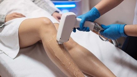 Up to 80% Off on Laser Hair Removal at Ebenezer Medical Clinic