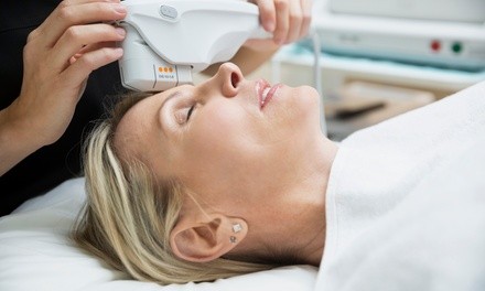 HIFU Ultrasound Lift for Full Face or Full Face and Neck at Cool Skin and Wellness (Up to 42% Off)