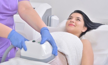 1, 3, 5, or 10 CryoSlimming and CryoToning Treatments at Impruv-U Medspa (Up to 50% Off)