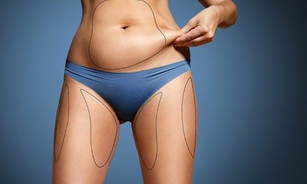 One or Two Fat Freeze Treatments with Two or Four 3D RF Lipo Sessions at Natural Beauty Clinique (Up to 78% Off)